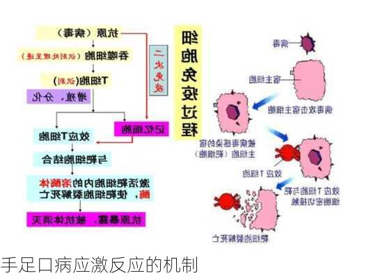 手足口病应激反应的机制