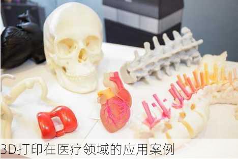 3D打印在医疗领域的应用案例