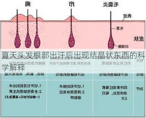 夏天头发根部出汗后出现结晶状东西的科学解释