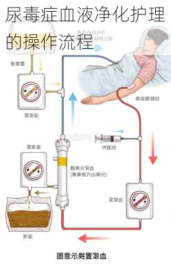 尿毒症血液净化护理的操作流程