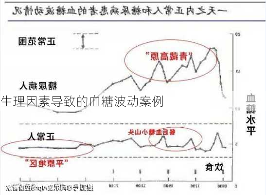 生理因素导致的血糖波动案例