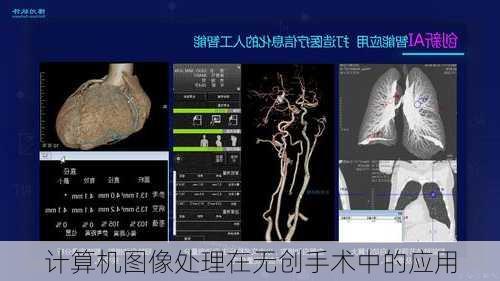 计算机图像处理在无创手术中的应用