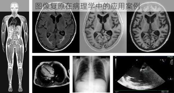 图像复原在病理学中的应用案例