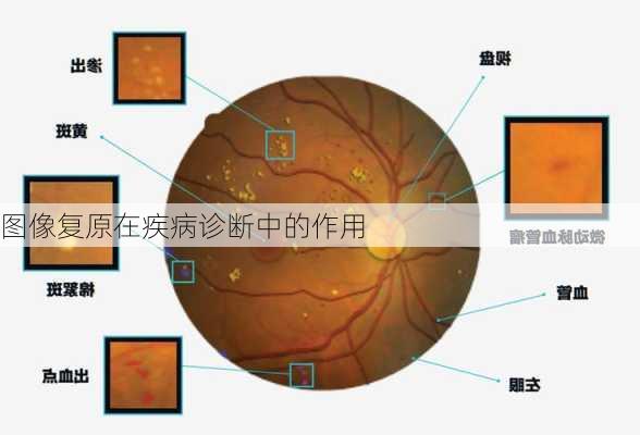 图像复原在疾病诊断中的作用