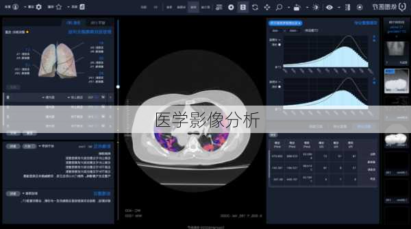 医学影像分析