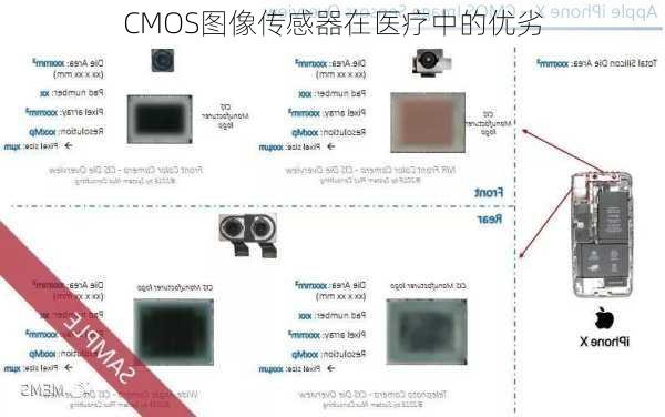 CMOS图像传感器在医疗中的优劣