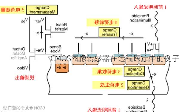 CMOS图像传感器在远程医疗中的例子