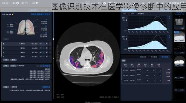 图像识别技术在医学影像诊断中的应用