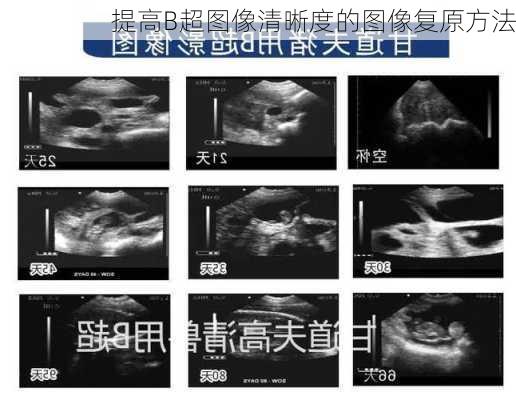 提高B超图像清晰度的图像复原方法