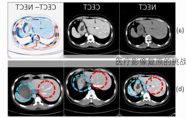 医疗影像复原的挑战