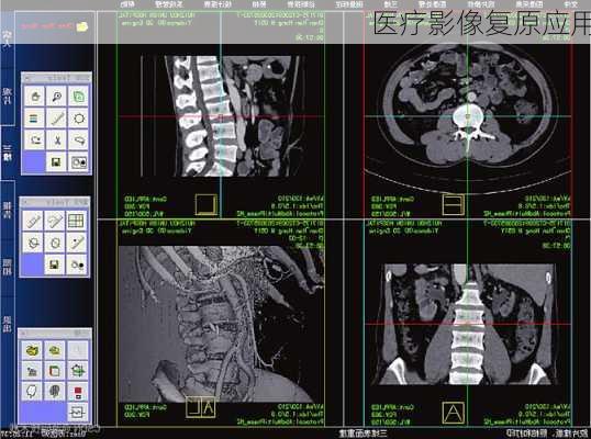 医疗影像复原应用