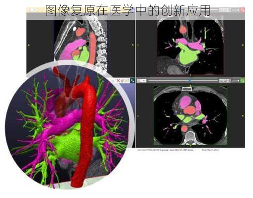 图像复原在医学中的创新应用