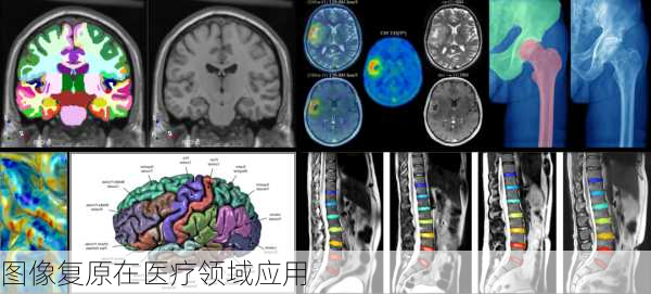 图像复原在医疗领域应用