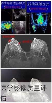 医学影像质量评估