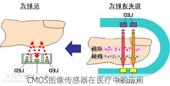 CMOS图像传感器在医疗中的应用