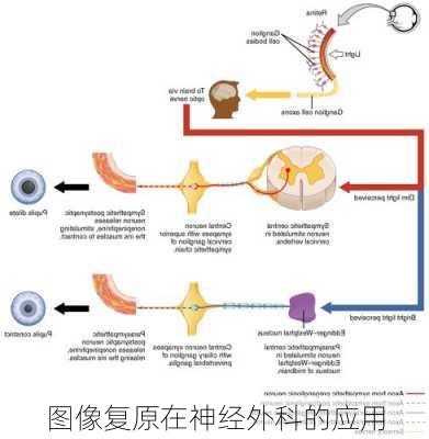 图像复原在神经外科的应用