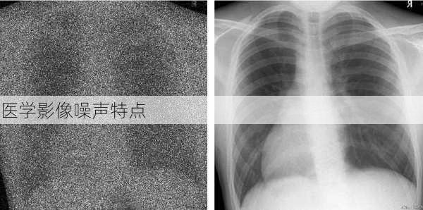 医学影像噪声特点