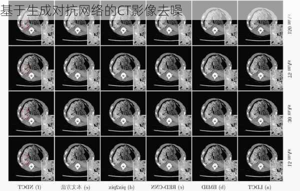 基于生成对抗网络的CT影像去噪