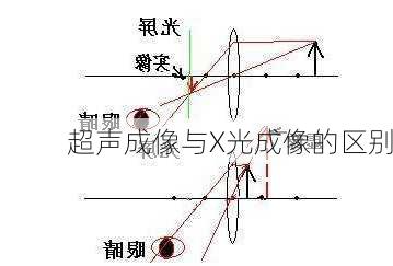 超声成像与X光成像的区别