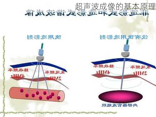 超声波成像的基本原理