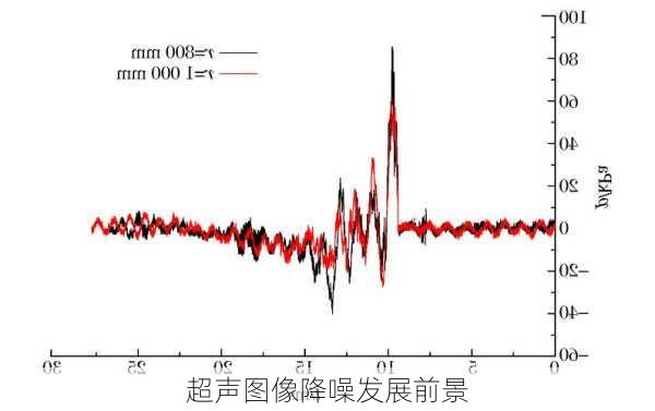 超声图像降噪发展前景