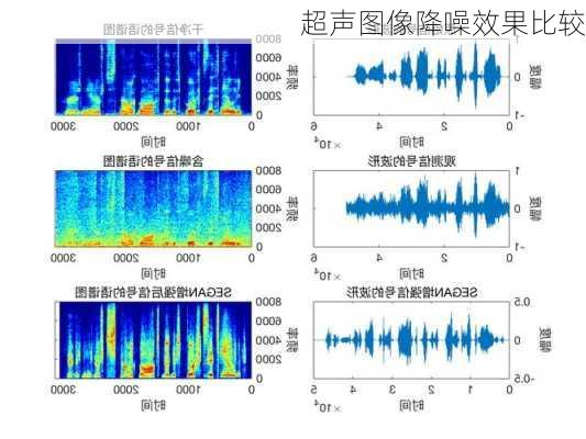 超声图像降噪效果比较