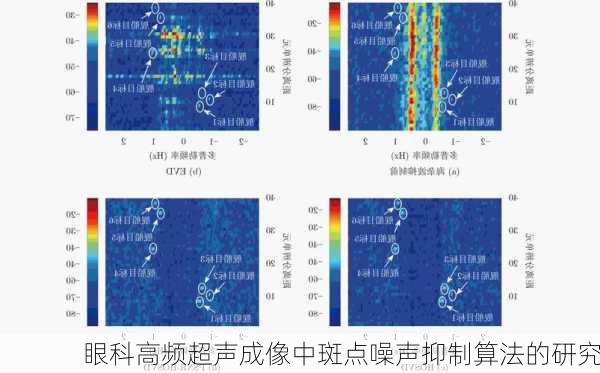 眼科高频超声成像中斑点噪声抑制算法的研究