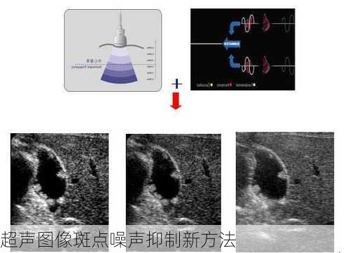 超声图像斑点噪声抑制新方法