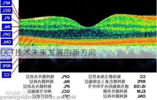 OCT技术未来发展的新方向