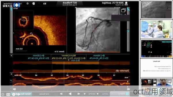 oct应用领域