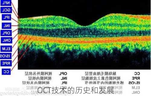 OCT技术的历史和发展