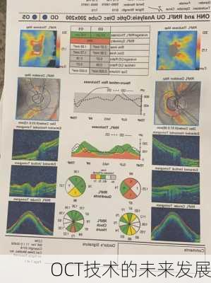 OCT技术的未来发展
