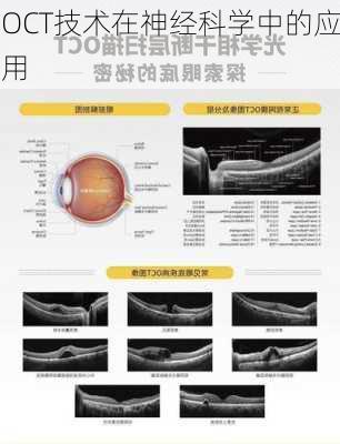 OCT技术在神经科学中的应用