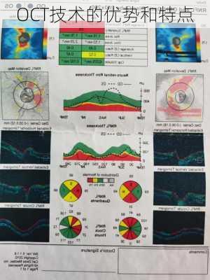OCT技术的优势和特点