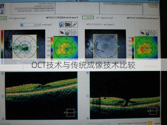 OCT技术与传统成像技术比较