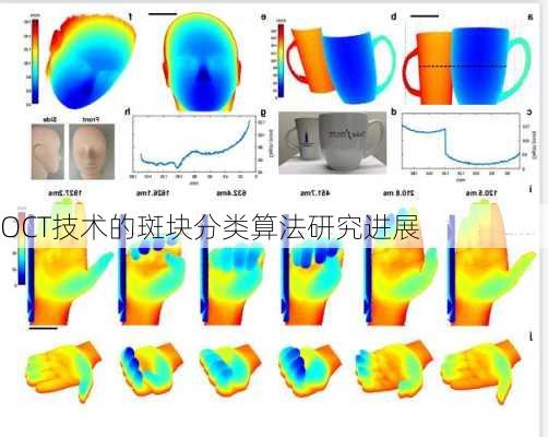 OCT技术的斑块分类算法研究进展