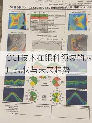 OCT技术在眼科领域的应用现状与未来趋势