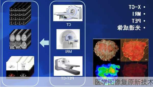 医学图像复原新技术