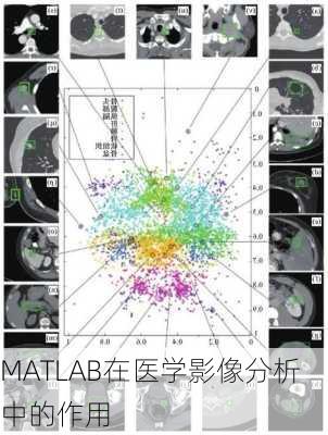 MATLAB在医学影像分析中的作用