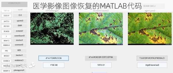 医学影像图像恢复的MATLAB代码