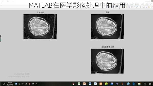 MATLAB在医学影像处理中的应用