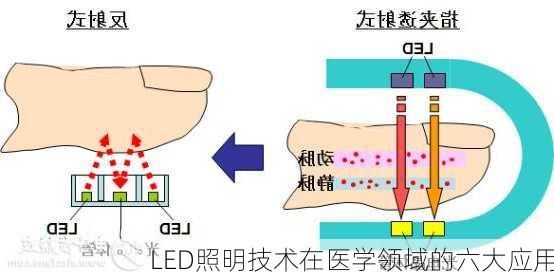 LED照明技术在医学领域的六大应用