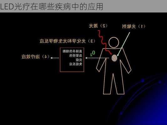 LED光疗在哪些疾病中的应用