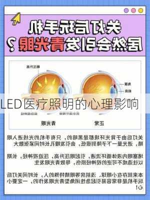 LED医疗照明的心理影响