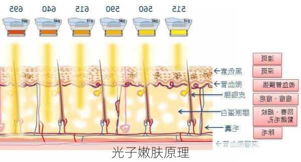 光子嫩肤原理