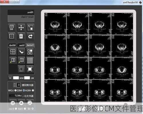 医疗影像DCM文件管理